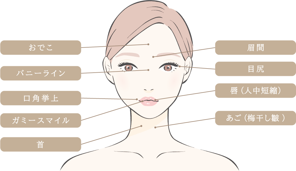 ボトックス注射の部位（顔）