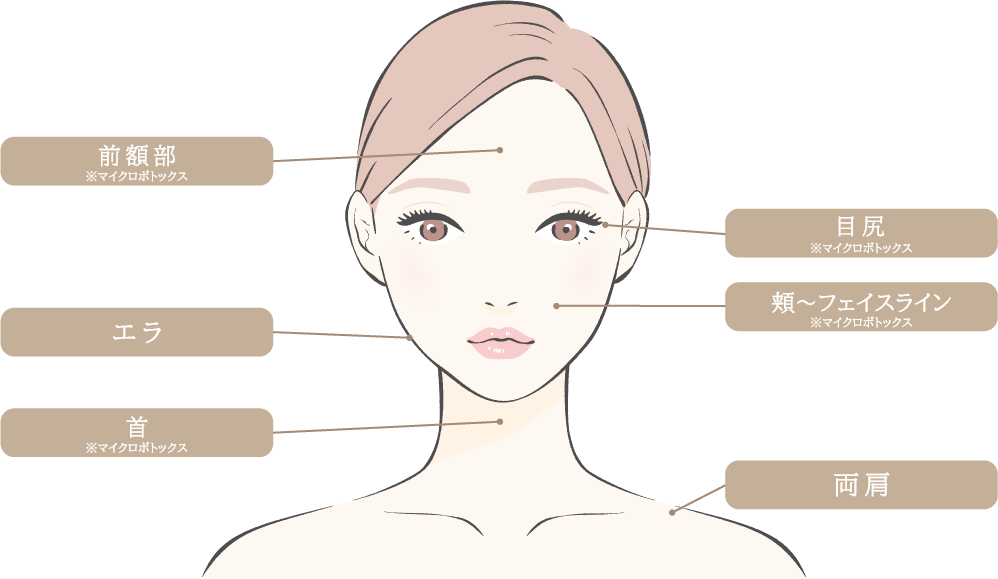 ボトックス注射の部位（顔）