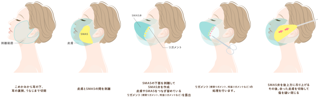 フェイスリスト