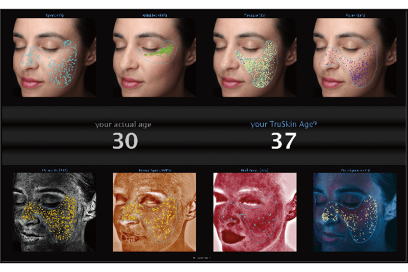 VISIA（ビジア）で可能な肌解析