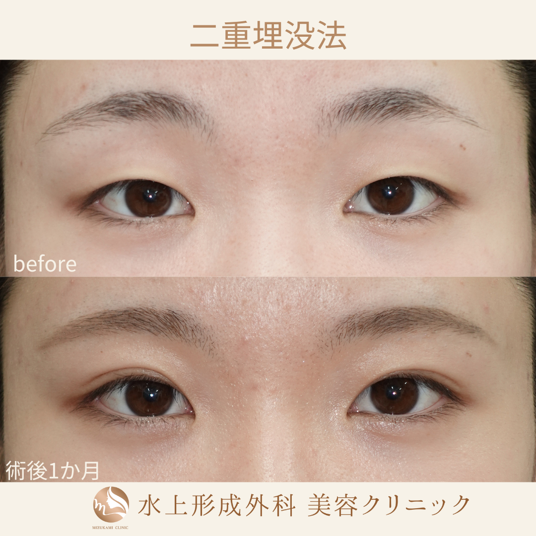 水上形成外科 美容クリニック｜浜松市の形成外科、美容外科、美容皮膚