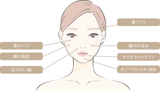 HIFU治療のおすすめ部位