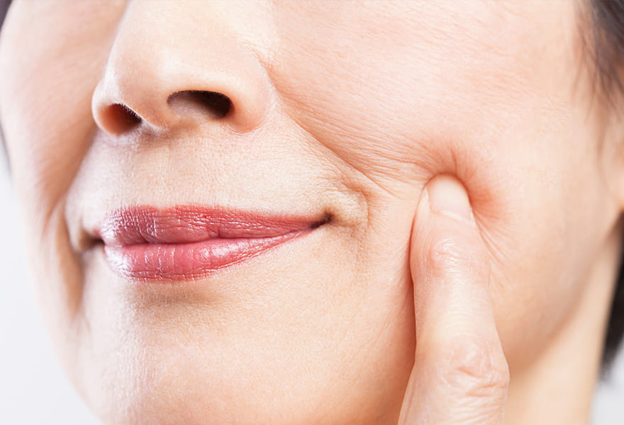 お顔のたるみ改善